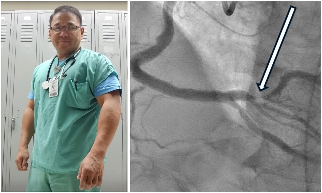 Queens man who survived heart attack urges: ‘Don’t wait’ for symptoms