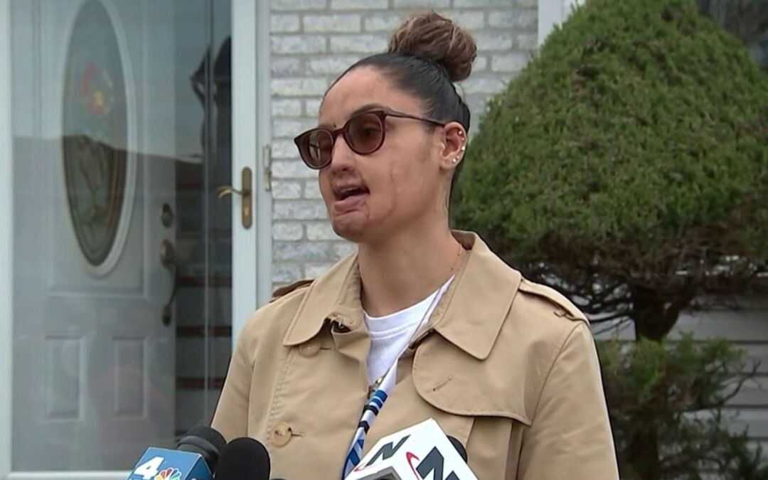 Arrest made in 2021 Long Island acid attack that left woman with severe burns: Sources