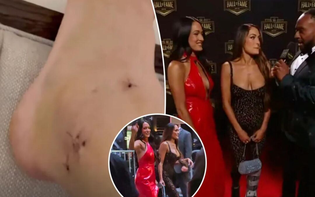 Nikki Bella shows photo of gruesome ankle injury that caused her to miss WrestleMania match