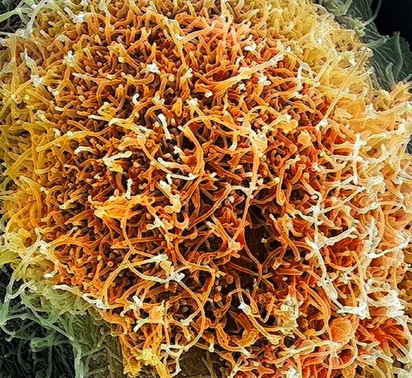 The Viruses Causing New Outbreaks Are Much Less Familiar to Science