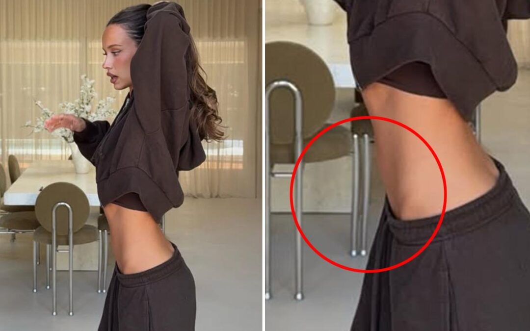 Influencer trashed for apparently manipulating photo to flatten belly — with bizarre result: ‘OMG this is insane’
