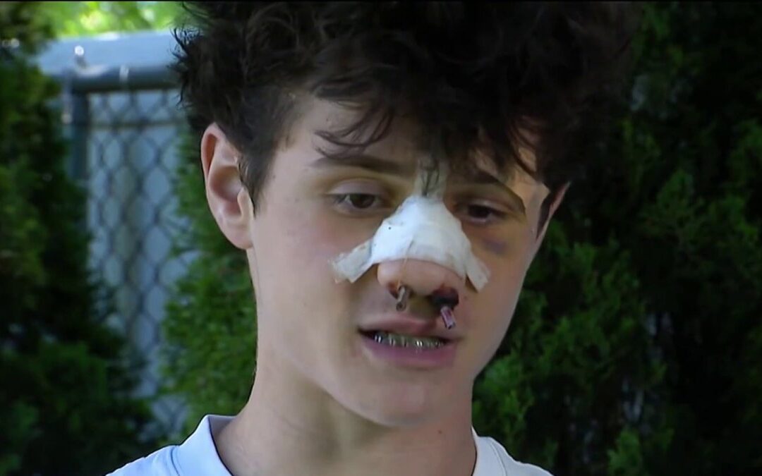 Teen hospitalized for days after brutal beating at Long Island house party
