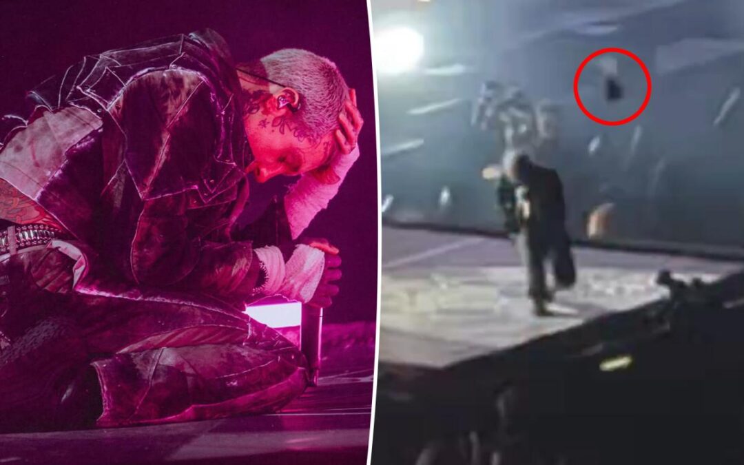 Bring Me the Horizon frontman Oli Sykes suffers concussion after fan throws phone at his head during concert