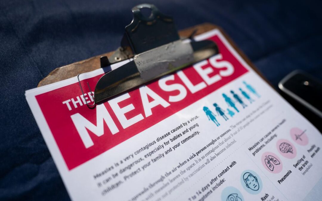 Health officials issue warning after 2nd case of measles on Long Island — with possible restaurant exposure