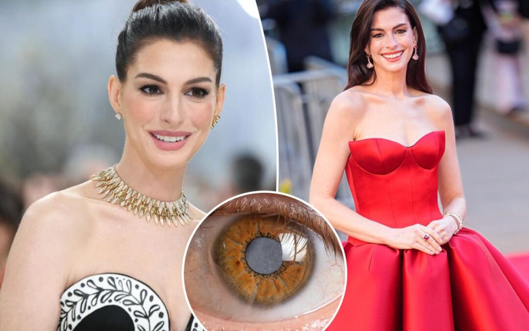 Anne Hathaway’s secret decade-long medical condition left her nearly blind throughout her 30s