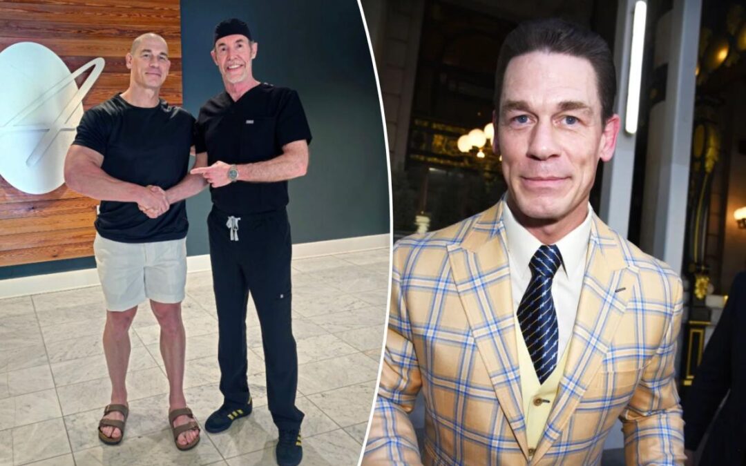 John Cena posts shocking bald photo as part of hair transplants